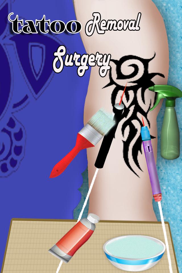 Tatoo Removal Surgery Game